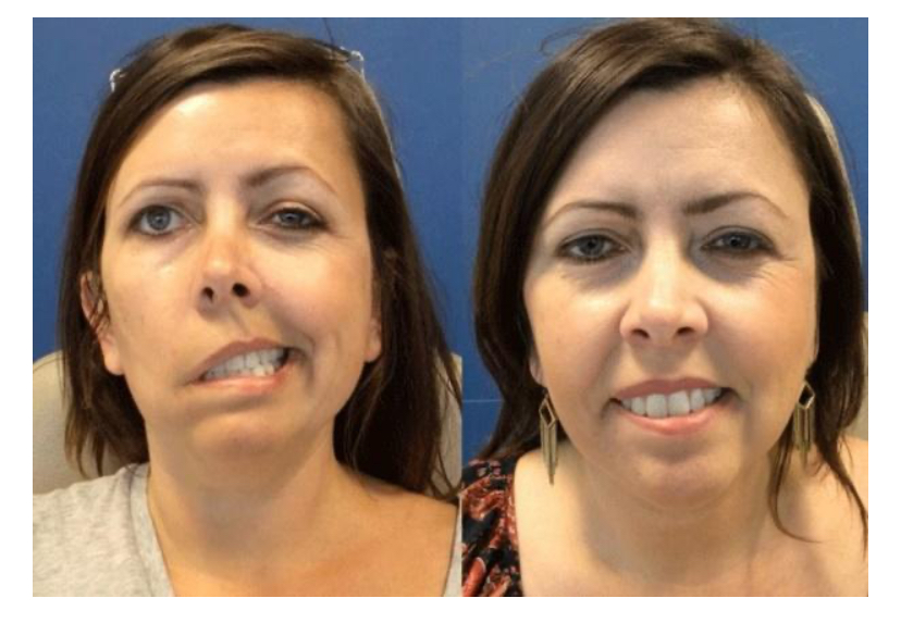 service gallary image one